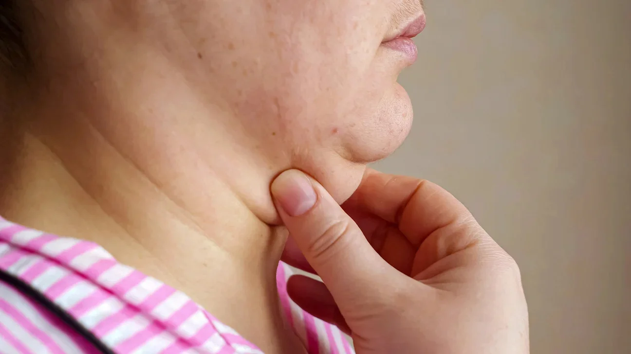 Double chin treatment image