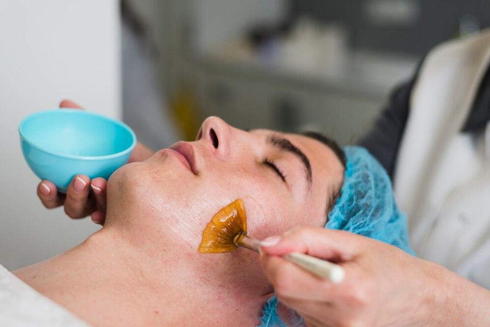 Mesopeel Chemical Peels