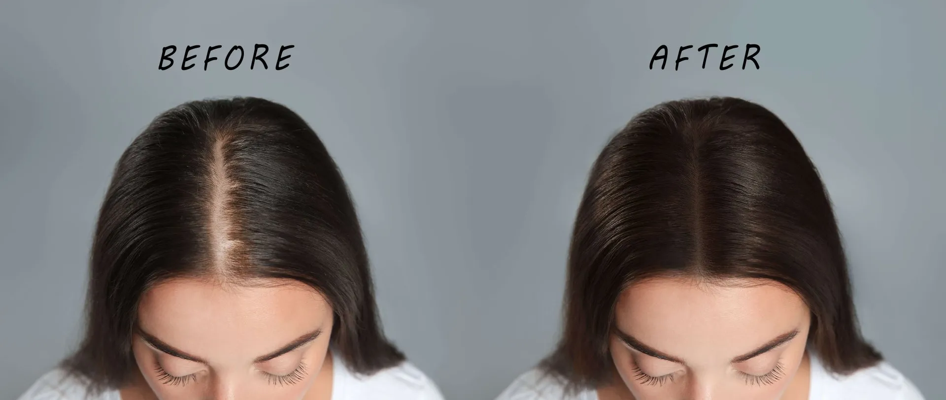 After Treatment