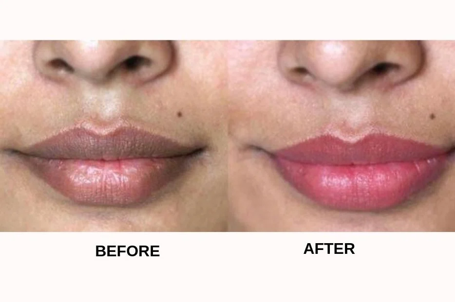 Dark_Lips